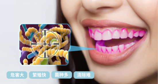 在做正畸吗?那你需要用iPMTC来管控口腔细菌环境