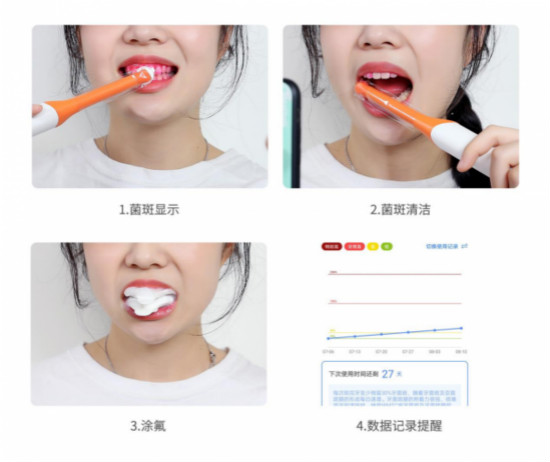 在做正畸吗?那你需要用iPMTC来管控口腔细菌环境