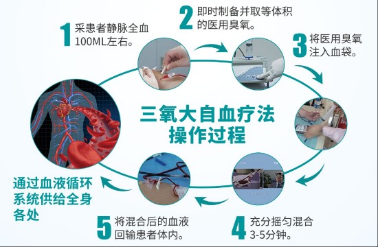 青岛静康中医肾脏病医院 三氧大自血疗法助力健康优势立显